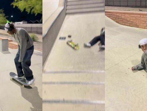 Skateboarder's teeth get smashed