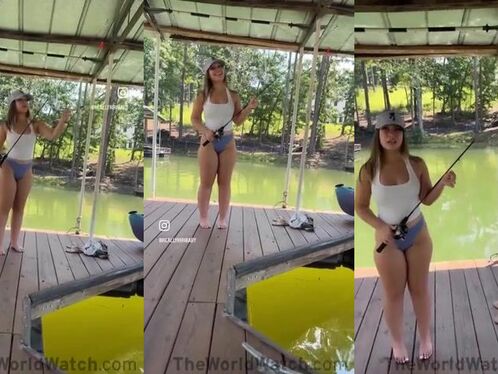 Woman has unusually shaped legs