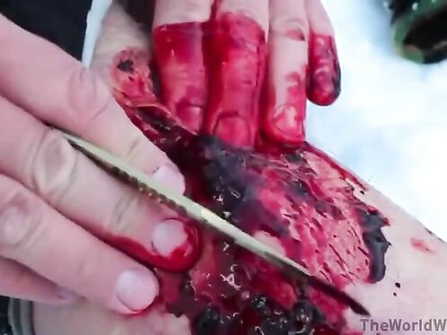 Man pulls small creature from deep laceration on leg