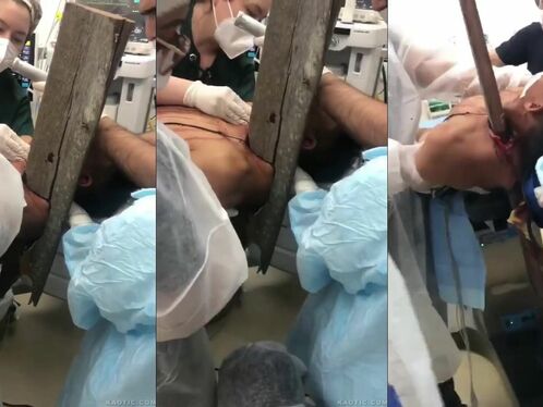 Doctors struggle to pull newborn from birth canal