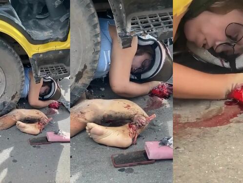Motorcyclist loses foot in gruesome road accident