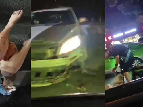 Girl on moped hit by speeding car