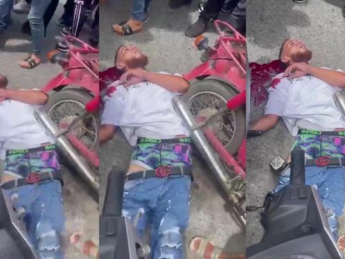Injured man lies on street next to crashed moped